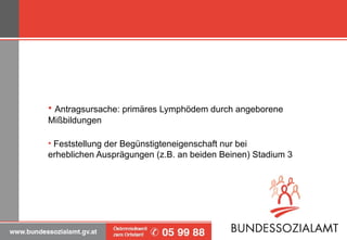 Antragsursache: primäres Lymphödem durch angeborene Mißbildungen Feststellung der Begünstigteneigenschaft nur bei erheblichen Ausprägungen (z.B. an beiden Beinen) Stadium 3 