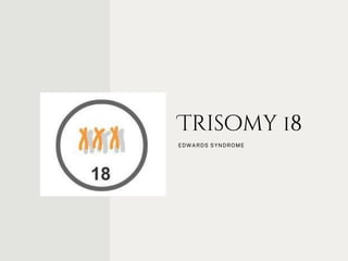 Trisomy 18
EDWARDS SYNDROME
 