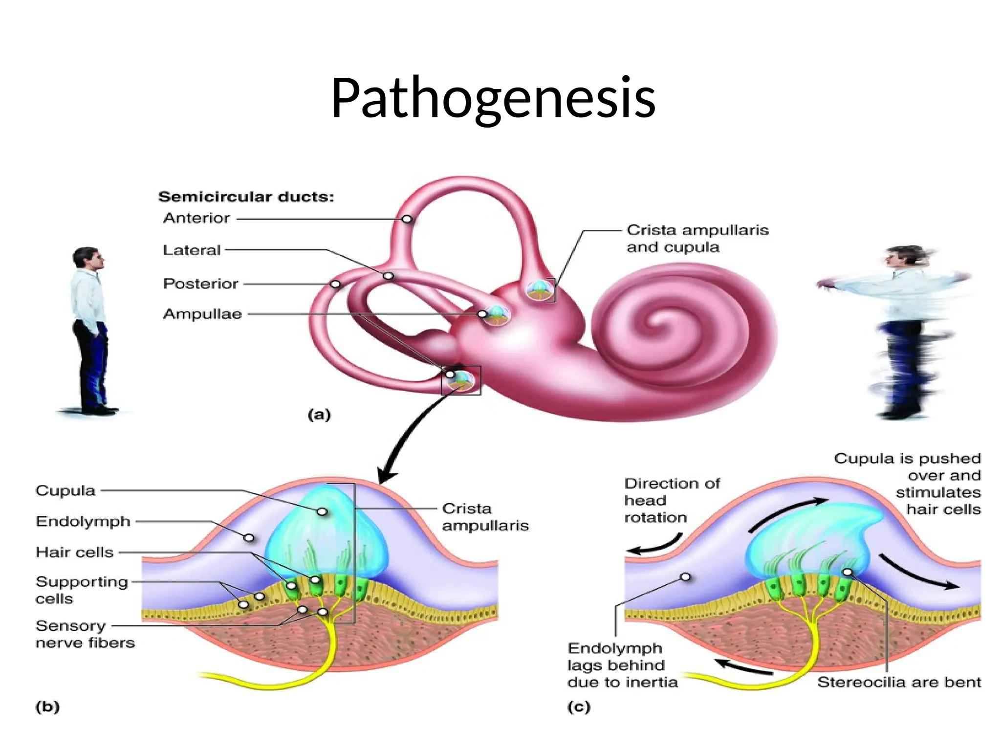 BENIGN PAROXYSMAL POSITIONAL VERTIGO.pptx | Free Download