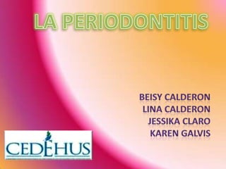 LA PERIODONTITIS BEISY CALDERON LINA CALDERON JESSIKA CLARO KAREN GALVIS 