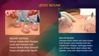 JENIS BEKAM
BEKAM KERING
hanya melakukan hisapan
pada permukaan kulit
tanpa dilukai atau disayat/
tanpa pengeluaran darah
BEKAM BASAH
mengeluarkan darah dari permukaan
kulit dengan cara melukai kulit dan
melakukan hisapan, sehingga ketika
kulit dihisap darah akan keluar dari
sayatan yang ada dipermukaan kulit
 