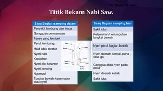 Titik Bekam Nabi Saw.
Saaq Bagian samping dalam
Penyakit lambung dan limpa
Gangguan pencernaan
Feses yang lembek
Perut kembung
Haid tidak teratur
Nyeri haid
Keputihan
Nyeri alat kelamin
Nyeri kencing
Ngompol
Tungkai bawah kesemutan
atau nyeri
* dr. Wadda’ A Umar
Saaq Bagian samping luar
Sakit lutut
Kelemahan/ kelumpuhan
tungkai bawah
Nyeri perut bagian bawah
Nyeri daerah lumbai, paha ,
sela iga
Ganggua atau nyeri pada
mata
Nyeri daerah ketiak
Sakit lutut
 