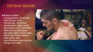 DEFINISI BEKAM
Bekam adalah
mengeluarkan darah dari
kulit dengan cara
menghisap, kemudian
penyayatan ringan pada
permukaan kulit, kemudian
dilakukan penghisapan
lagi agar darah (racun atau
toksin dari tubuh badan)
bisa keluar dan
menimbulkan kesembuhan
dengan izin Allah
 