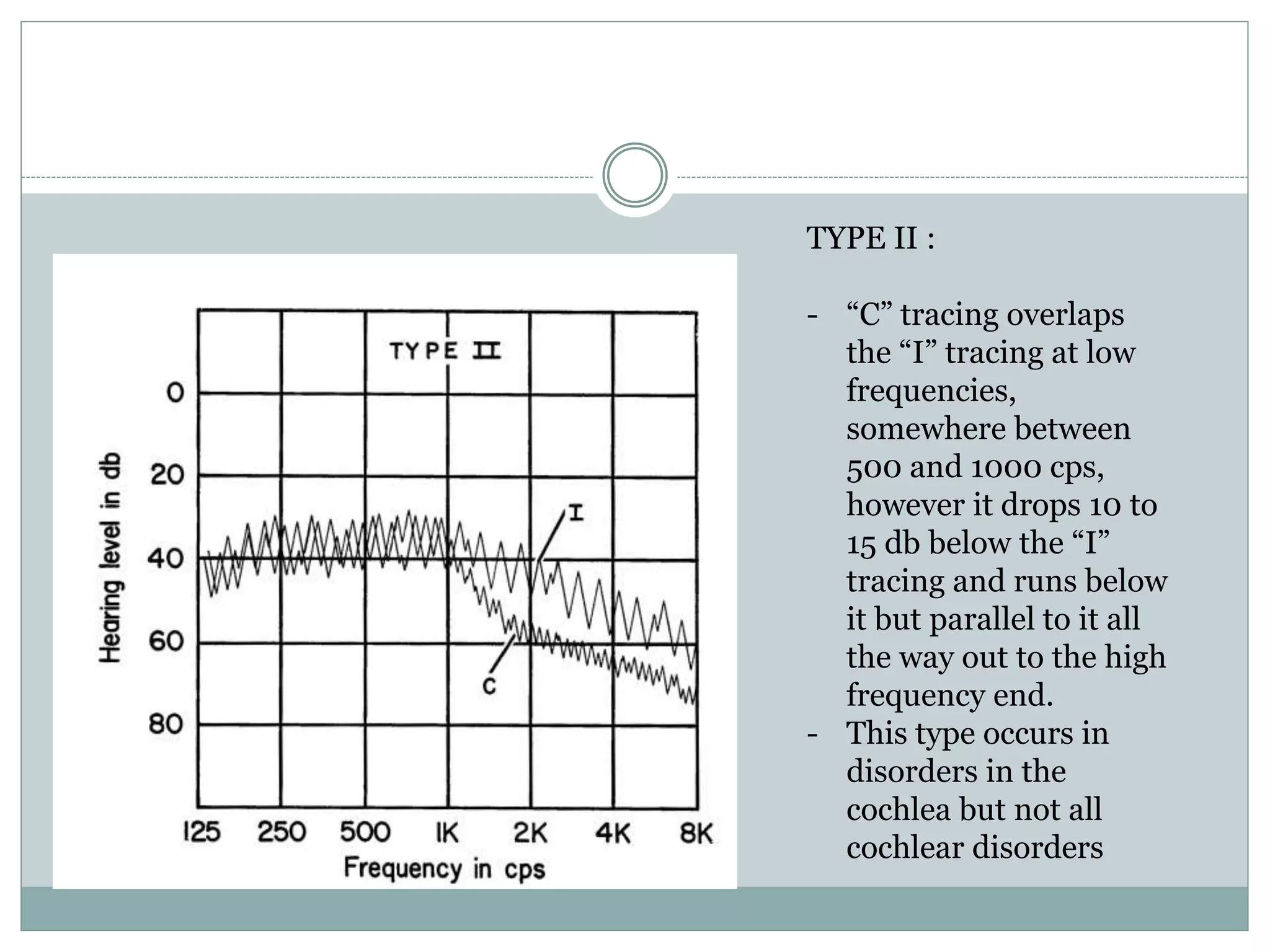 Bekesy Audiometry | PPTX