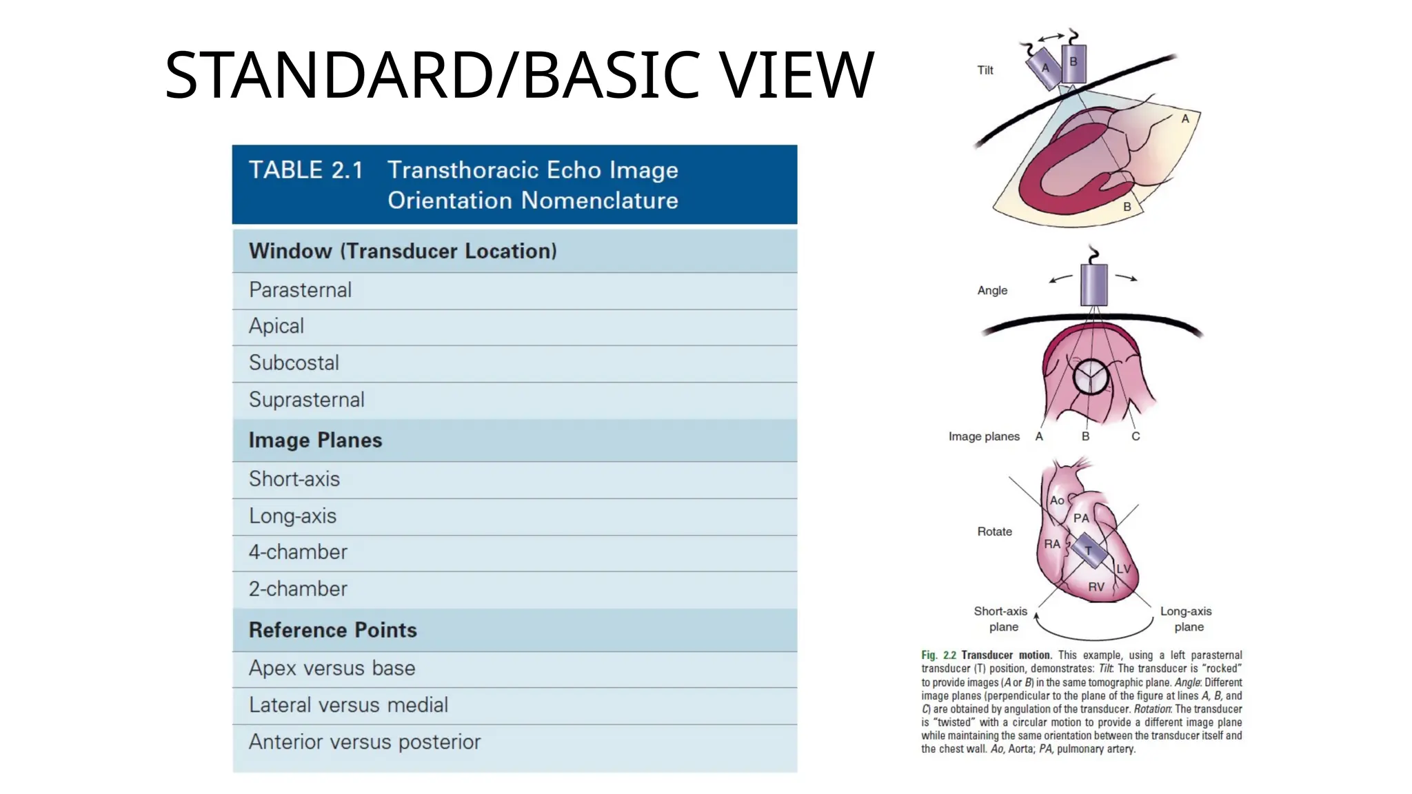 Echo interpreting (97) 사진