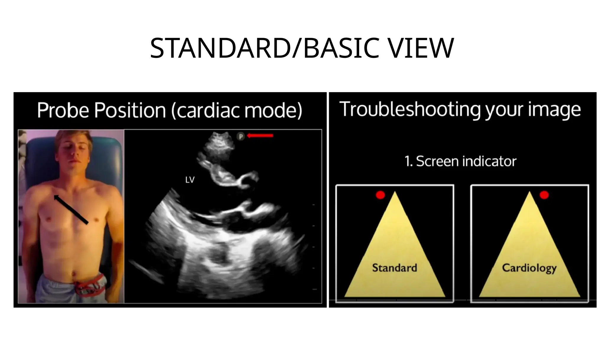 BELAJAR ECHO a practical guide for reporting and interpretation.pptx
