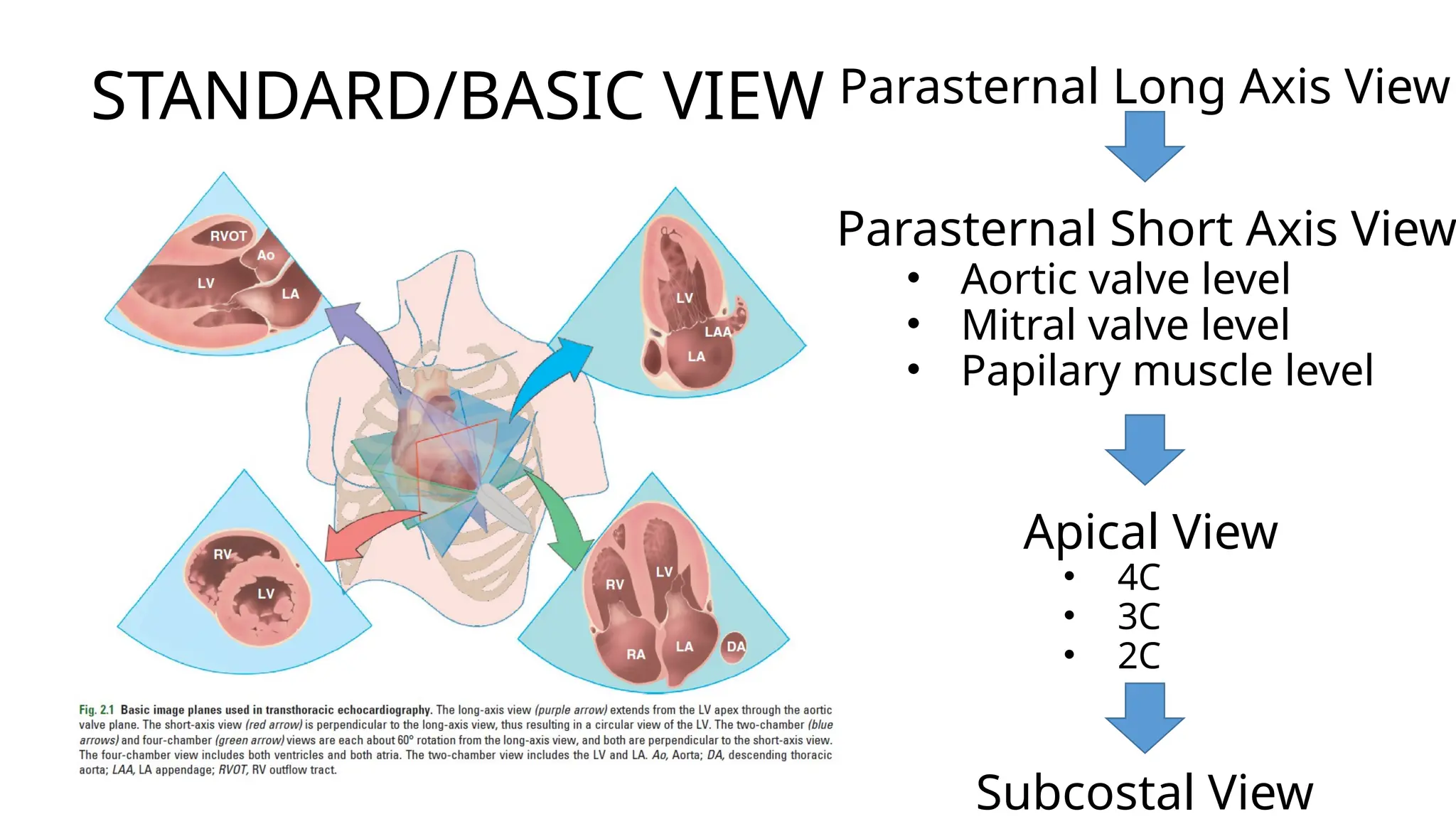 BELAJAR ECHO a practical guide for reporting and interpretation.pptx