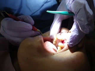 Mission to save teeth in Belize Nov '13