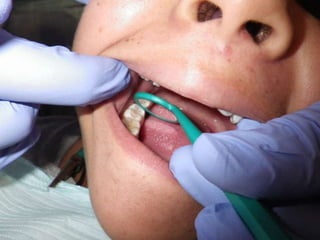 Mission to save teeth in Belize Nov '13