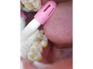 Mission to save teeth in Belize Nov '13