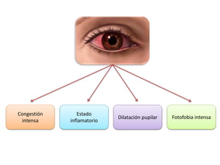Congestión
intensa
Estado
inflamatorio
Dilatación pupilar Fotofobia intensa
 