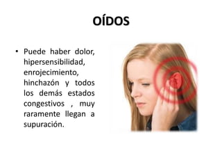 OÍDOS
• Puede haber dolor,
hipersensibilidad,
enrojecimiento,
hinchazón y todos
los demás estados
congestivos , muy
raramente llegan a
supuración.
 