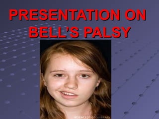 PRESENTATION ON
  BELL’S PALSY
 