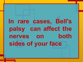 In rare cases, Bell's
palsy can affect the
nerves on both
sides of your face
 