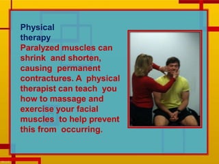 Physical
therapy
Paralyzed muscles can
shrink and shorten,
causing permanent
contractures. A physical
therapist can teach you
how to massage and
exercise your facial
muscles to help prevent
this from occurring.
 