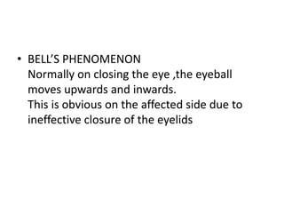 Bells palsy | PPTX