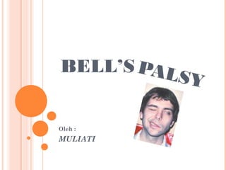 PALSY
Oleh :
MULIATI
BELL’S
 
