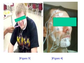 )Figure 4()Figure 5(
 