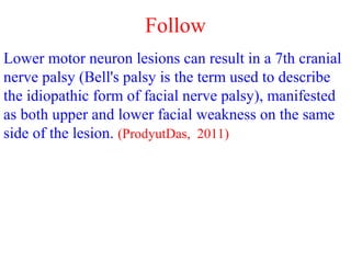 Follow
Lower motor neuron lesions can result in a 7th cranial
nerve palsy (Bell's palsy is the term used to describe
the idiopathic form of facial nerve palsy), manifested
as both upper and lower facial weakness on the same
side of the lesion. (ProdyutDas, 2011)
 