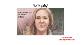 “Bell's palsy”
PRESENTED BY:
MR. ABHAY RAJPOOT
 