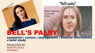 PRESENTED BY
MARTIN SHAJI
PHARM D
BELL'S PALSY
symptoms | causes | management | medical information|
a brief study
 