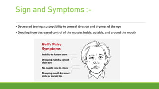 Bell's Palsy and PT Management.pptx