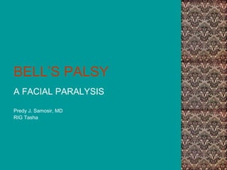 BELL’S PALSY
A FACIAL PARALYSIS
Predy J. Samosir, MD
RIG Tasha
 
