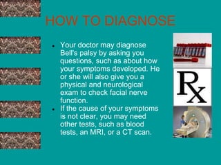 HOW TO DIAGNOSE
● Your doctor may diagnose
Bell's palsy by asking you
questions, such as about how
your symptoms developed...