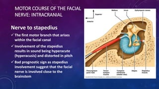 Bell's Palsy | PPTX