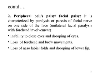 Bell's Palsy_BNS 3rd year.CMC.edu...pptx