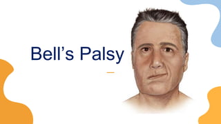 Bell’s Palsy
 