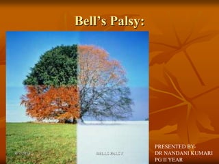 Bell’s Palsy:
PRESENTED BY-
DR NANDANI KUMARI
PG II YEAR
10/7/2013 1BELLS PALSY
 