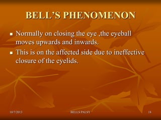 Bell's Reflex Bells palsy | PPTX