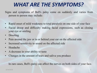 Physiotherapy Treatment For Bell S Palsy