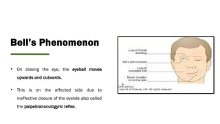 Comprehensive Approach to Bell's Palsy Management | PPTX