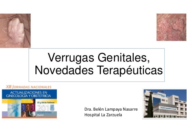 imiquimod verrugas precio