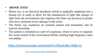 • BIONIC EYES
• Bionic eye, is an electrical prosthesis which is surgically implanted into a
human eye in order to allow for the transduction of light (the change of
light from the environment into impulses the brain can process) in people
who have sustained severe damage to the retina.
• The bionic eye comprises an external camera and transmitter and an
internal microchip.
• The camera is mounted on a pair of eyeglasses, where it serves to organize
the visual stimuli of the environment before emitting high-frequency radio
waveshttps
https://www.youtube.com/watch?v=05ee61Bu-Ok&t=1s
www.youtube.com/watch?v=WhYe6REdljw
 