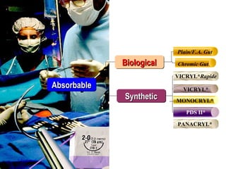 PELATIHAN BEDAH DASAR
KOLEGIUM ILMU BEDAH INDONESIAKOLEGIUM ILMU BEDAH INDONESIA
AbsorbableAbsorbableAbsorbableAbsorbable
BiologicalBiologicalBiologicalBiological
SyntheticSyntheticSyntheticSynthetic
Plain/F.A. Gut
Chromic Gut
VICRYL*
PDS II*
MONOCRYL*
VICRYL*Rapide
PANACRYL*
* Trademark
 