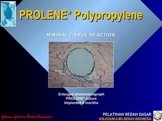 PELATIHAN BEDAH DASAR
KOLEGIUM ILMU BEDAH INDONESIAKOLEGIUM ILMU BEDAH INDONESIA
PROLENE* PolypropylenePROLENE* Polypropylene
MINIMAL TISSUE REACTIONMINIMAL TISSUE REACTION
Enlarged photomicrograph
PROLENE* suture
Implanted 6 months
 