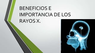 BENEFICIOS E
IMPORTANCIA DE LOS
RAYOS X.
 