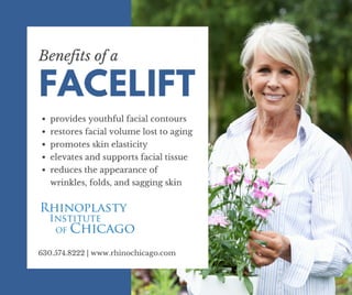 Benefits of a facelift