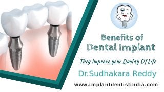www.implantdentistindia.com
Dental Implant
They Improve your Quality Of Life
Benefits of
 