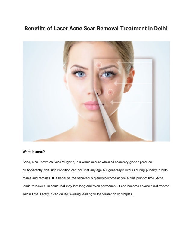 scar removal treatment