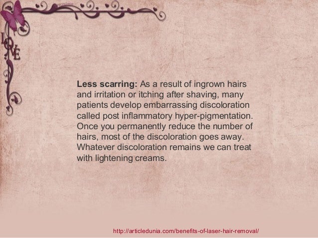 Benefits Of Laser Hair Removal Treatment