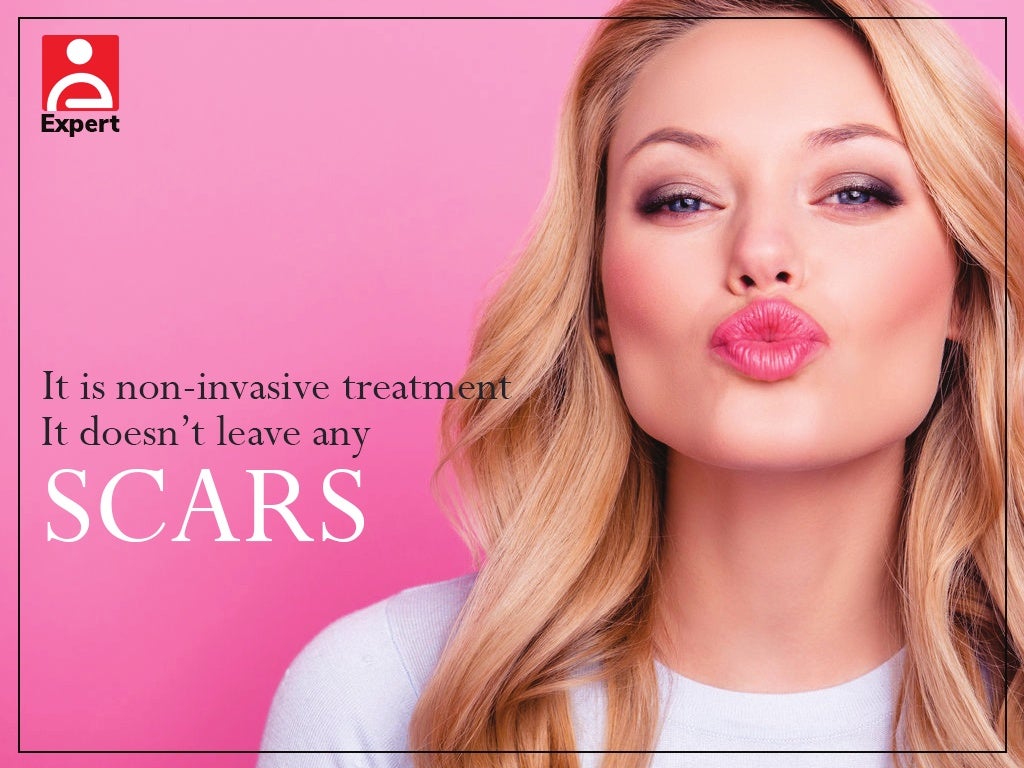 Benefits of Lip Fillers Treatment