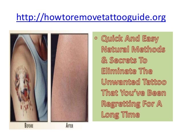 Benefits Of Magnetic Tattoo Removal, Reviews And Costs
