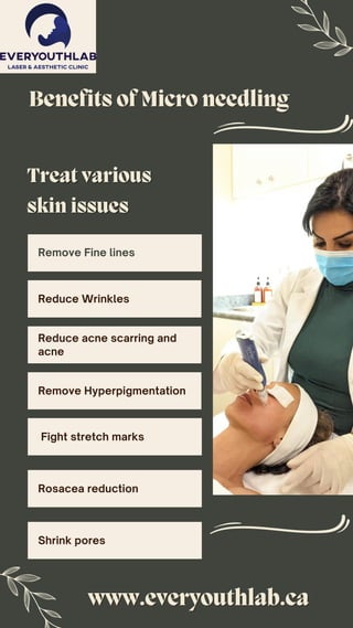 Treat various
Treat various
skin issues
skin issues
www.everyouthlab.ca
www.everyouthlab.ca
Benefits of Micro needling
Benefits of Micro needling
Remove Fine lines
Reduce Wrinkles
Reduce acne scarring and
acne
Remove Hyperpigmentation
Fight stretch marks
Rosacea reduction
Shrink pores
 