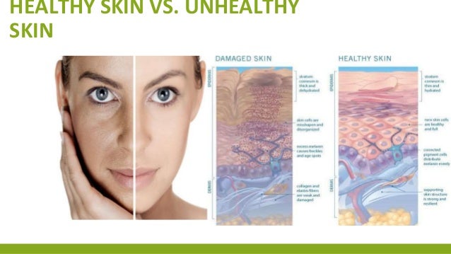 Healthy Skin Vs Unhealthy Skin Healthy Skin Vs Unhealthy Skin