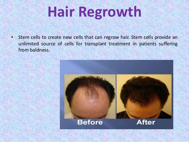 Benefits And Function Of Stem Cell Therapy Dr Sid Mirrafati
