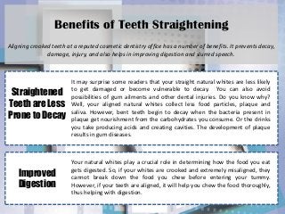 Benefits of Teeth Straightening 
Aligning crooked teeth at a reputed cosmetic dentistry office has a number of benefits. It prevents decay, damage, injury, and also helps in improving digestion and slurred speech. 
Straightened Teeth are Less Prone to Decay 
It may surprise some readers that your straight natural whites are less likely to get damaged or become vulnerable to decay. You can also avoid possibilities of gum ailments and other dental injuries. Do you know why? Well, your aligned natural whites collect less food particles, plaque and saliva. However, bent teeth begin to decay when the bacteria present in plaque get nourishment from the carbohydrates you consume. Or the drinks you take producing acids and creating cavities. The development of plaque results in gum diseases. 
Improved Digestion 
Your natural whites play a crucial role in determining how the food you eat gets digested. So, if your whites are crooked and extremely misaligned, they cannot break down the food you chew before entering your tummy. However, if your teeth are aligned, it will help you chew the food thoroughly, thus helping with digestion.  